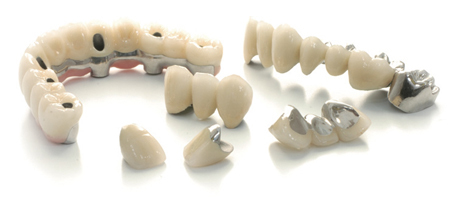 須山歯研の架橋義歯